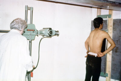 A person in a white coat operates an x-ray machine as a shirtless man presses his chest against an x-ray plate.